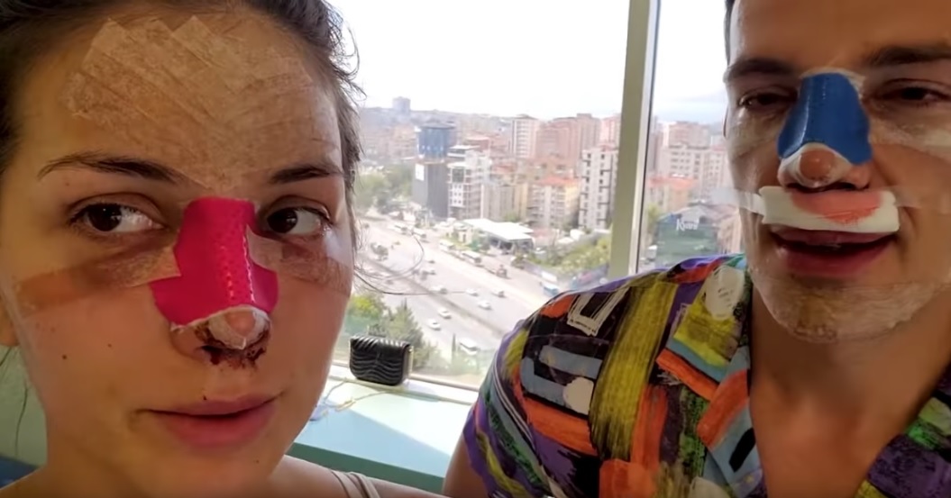 Ето го новото носле на Алекс Петканова – показа го! (СНИМКА)